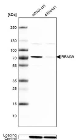 HCC1 Antibody, Novus Biologicals 0.1mL; Unlabeled:Antibodies, Polyclonal