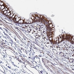 HCCA2 Antibody, Novus Biologicals 0.1mL; Unlabeled:Antibodies, Polyclonal