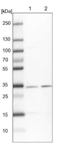 HCCS Antibody, Novus Biologicals 25 &mu;L; Unlabeled:Antibodies, Polyclonal
