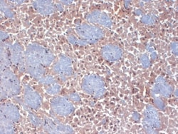 HCN2 Antibody (S71-37), Novus Biologicals 0.1mg; Unlabeled:Antibodies,