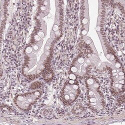 HDAC1 Antibody, Novus Biologicals:Antibodies:Primary Antibodies