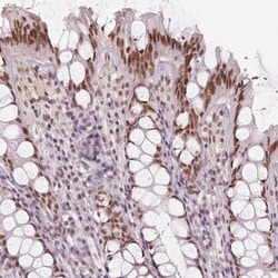 HDAC1 Antibody, Novus Biologicals:Antibodies:Primary Antibodies