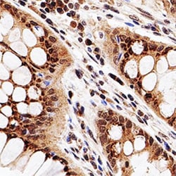 HDAC3 Antibody, Novus Biologicals:Antibodies:Primary Antibodies