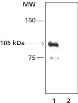 HDAC7 Antibody, Novus Biologicals 0.025 mL, Unconjugated:Antibodies, Polyclonal