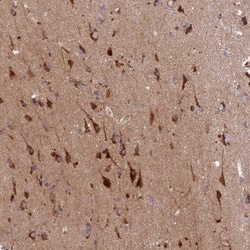 HDC Antibody, Novus Biologicals:Antibodies:Primary Antibodies
