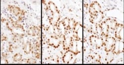 HDGF Antibody, Novus Biologicals 0.1mL; Unlabeled:Antibodies, Polyclonal
