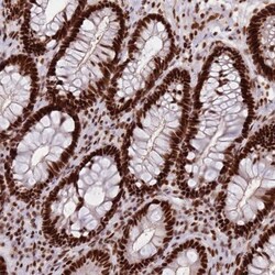 HRP-2 Antibody, Novus Biologicals 0.1mL; Unlabeled:Antibodies, Polyclonal