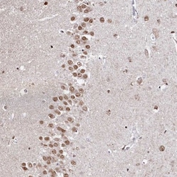 HDGFRP3 Antibody, Novus Biologicals 0.1mL; Unlabeled:Antibodies, Polyclonal