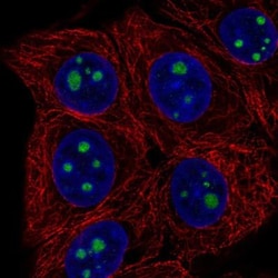 HDHD3 Antibody, Novus Biologicals 25 &mu;L; Unlabeled:Antibodies, Polyclonal