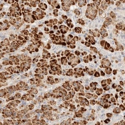 HDHD3 Antibody, Novus Biologicals 25 &mu;L; Unlabeled:Antibodies, Polyclonal