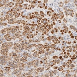 SP1 Antibody, Novus Biologicals:Antibodies:Primary Antibodies