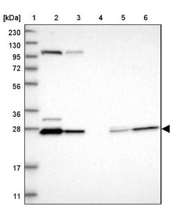 HDHD3 Antibody, Novus Biologicals 25 &mu;L; Unlabeled:Antibodies, Polyclonal