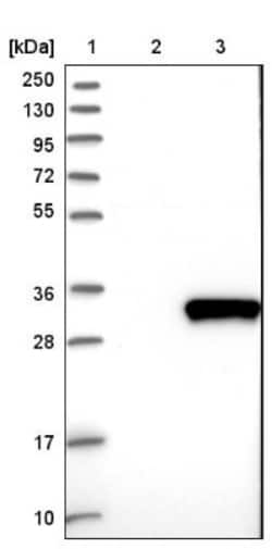 Vimentin Antibody, Novus Biologicals:Antibodies:Primary Antibodies