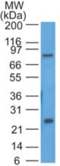 HE4/WFDC2 Antibody, Novus Biologicals:Antibodies:Primary Antibodies