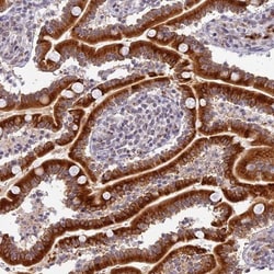 HEATR5B Antibody, Novus Biologicals:Antibodies:Primary Antibodies