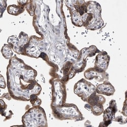 HEATR6 Antibody, Novus Biologicals 0.1mL; Unlabeled:Antibodies, Polyclonal