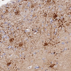 HEATR7A Antibody, Novus Biologicals 0.1mL; Unlabeled:Antibodies, Polyclonal