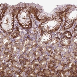 HEATR7B1 Antibody, Novus Biologicals:Antibodies:Primary Antibodies