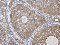 HEBP1 Antibody, Novus Biologicals 0.1mL; Unlabeled:Antibodies, Polyclonal