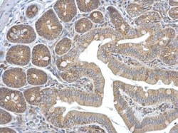 HEBP1 Antibody, Novus Biologicals 0.1mL; Unlabeled:Antibodies, Polyclonal