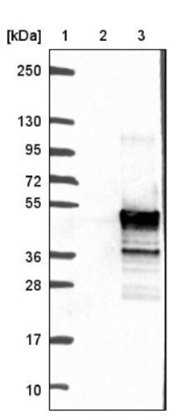 HEXIM2 Antibody, Novus Biologicals 0.1mL; Unlabeled:Antibodies, Polyclonal