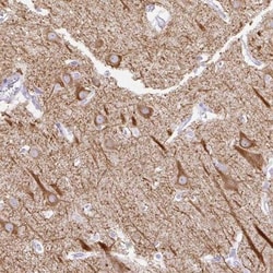 HEY1 Antibody, Novus Biologicals 0.1mL; Unlabeled:Antibodies, Polyclonal