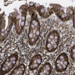 HFE Antibody, Novus Biologicals 25 &mu;L | Buy Online | Novus Biologicals | Fisher Scientific