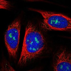 HGD Antibody, Novus Biologicals 0.1mL; Unlabeled:Antibodies, Polyclonal