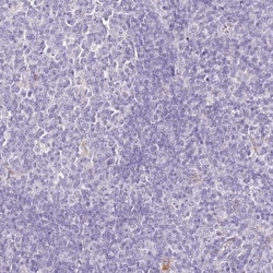 HGD Antibody, Novus Biologicals 0.1mL; Unlabeled:Antibodies, Polyclonal