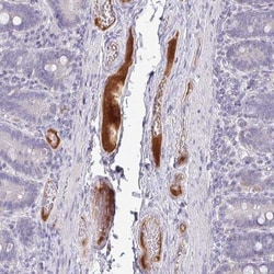 HGF Activator Antibody, Novus Biologicals:Antibodies:Primary Antibodies