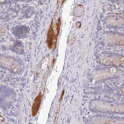 HGF Activator Antibody, Novus Biologicals 0.1mL; Unlabeled:Antibodies,