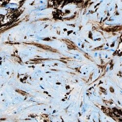HGFR/c-MET Antibody (1G7NB) - Azide and BSA Free, Novus Biologicals 0.1mg;