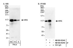 HGS Antibody, Novus Biologicals 0.1mL; Unlabeled:Antibodies, Polyclonal