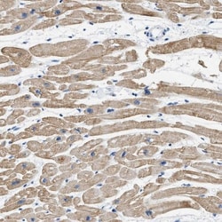 GALM Antibody, Novus Biologicals:Antibodies:Primary Antibodies