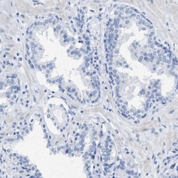 GALM Antibody, Novus Biologicals:Antibodies:Primary Antibodies