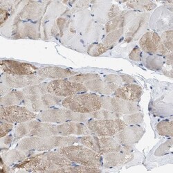 GALM Antibody, Novus Biologicals:Antibodies:Primary Antibodies