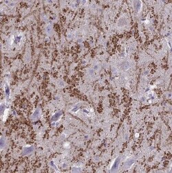 HHLA1 Antibody, Novus Biologicals:Antibodies:Primary Antibodies