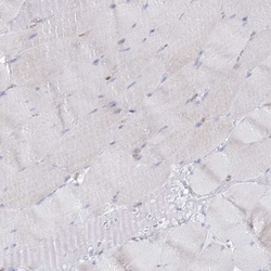 HIBCH Antibody, Novus Biologicals:Antibodies:Primary Antibodies