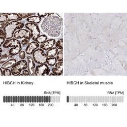 HIBCH Antibody, Novus Biologicals:Antibodies:Primary Antibodies