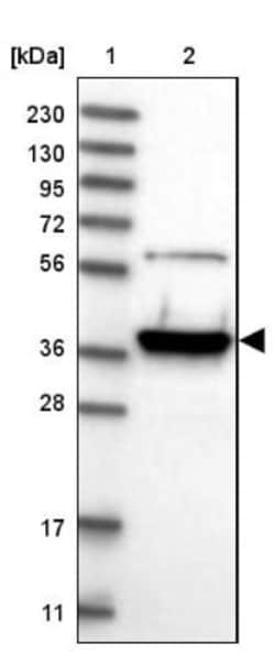 HIBCH Antibody, Novus Biologicals:Antibodies:Primary Antibodies