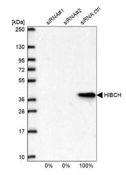 HIBCH Antibody, Novus Biologicals:Antibodies:Primary Antibodies