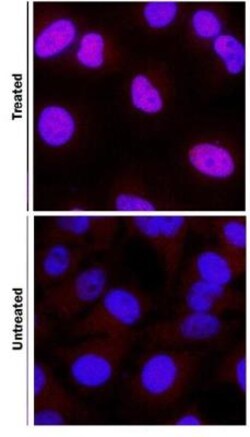 HIF-1 alpha Antibody (H1alpha67), Novus Biologicals 0.1mL; Unlabeled:Antibodies,