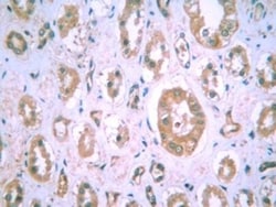 HIF-1 alpha Antibody (H1alpha67), Novus Biologicals:Antibodies:Primary