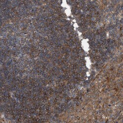 HIP-55 Antibody, Novus Biologicals 0.1mL; Unlabeled:Antibodies, Polyclonal