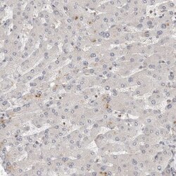 HIP-55 Antibody, Novus Biologicals 0.1mL; Unlabeled:Antibodies, Polyclonal