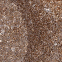 HIP-55 Antibody, Novus Biologicals 0.1mL; Unlabeled:Antibodies, Polyclonal