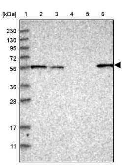 HIP-55 Antibody, Novus Biologicals 0.1mL; Unlabeled:Antibodies, Polyclonal