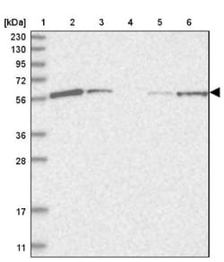 HIP-55 Antibody, Novus Biologicals 0.1mL; Unlabeled:Antibodies, Polyclonal
