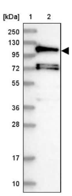 HIP1 Related Antibody, Novus Biologicals:Antibodies:Primary Antibodies