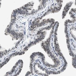 HIPK1 Antibody, Novus Biologicals:Antibodies:Primary Antibodies
